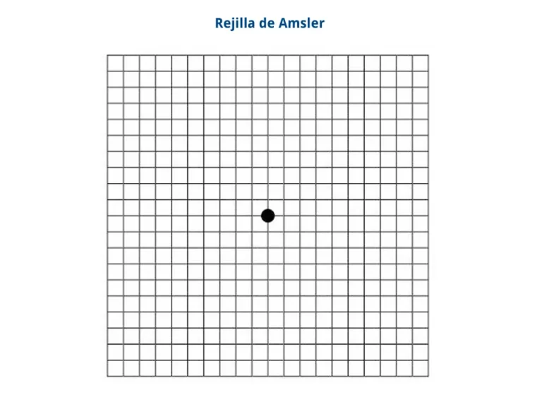 Rejilla Amsler