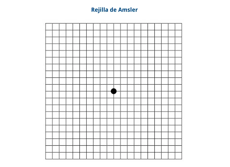 Rejilla Amsler | Oftalmoceuta - Centro de Ojos de Ceuta · Dr. Medín filename sep oftalmoceuta