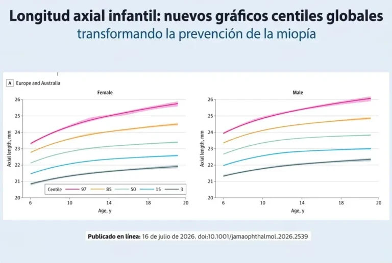 longitud axial infantil miopía